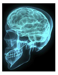Brain xray